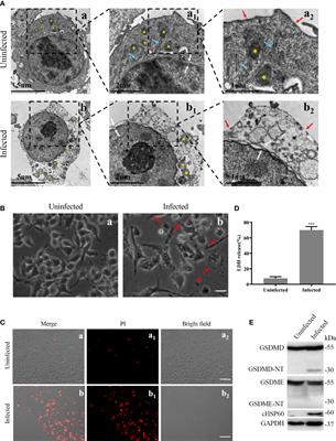 GSDMD-mediated pyroptosis restrains intracellular Chlamydia trachomatis growth in macrophages